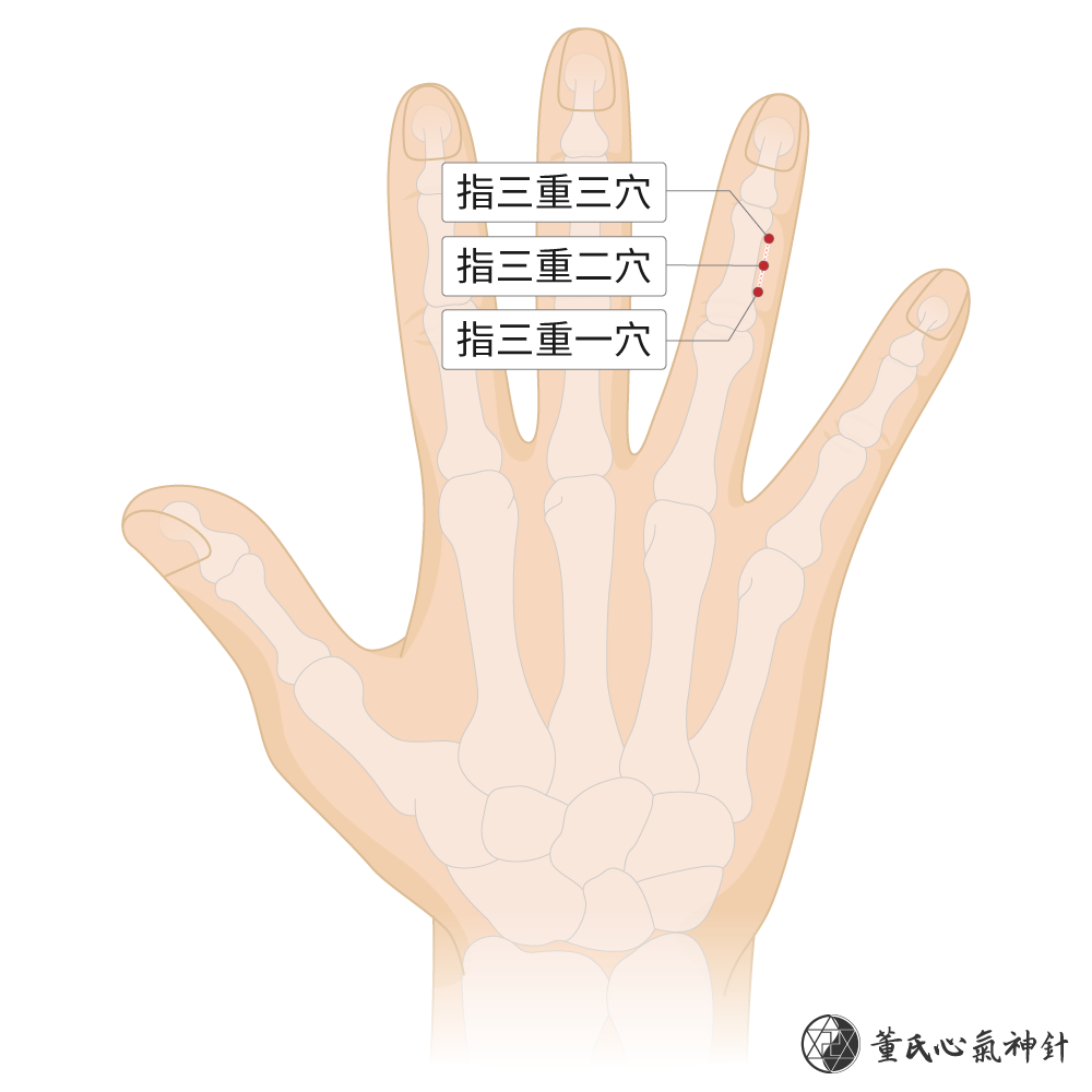指三重穴位於無名指背面指三重區右手示意圖