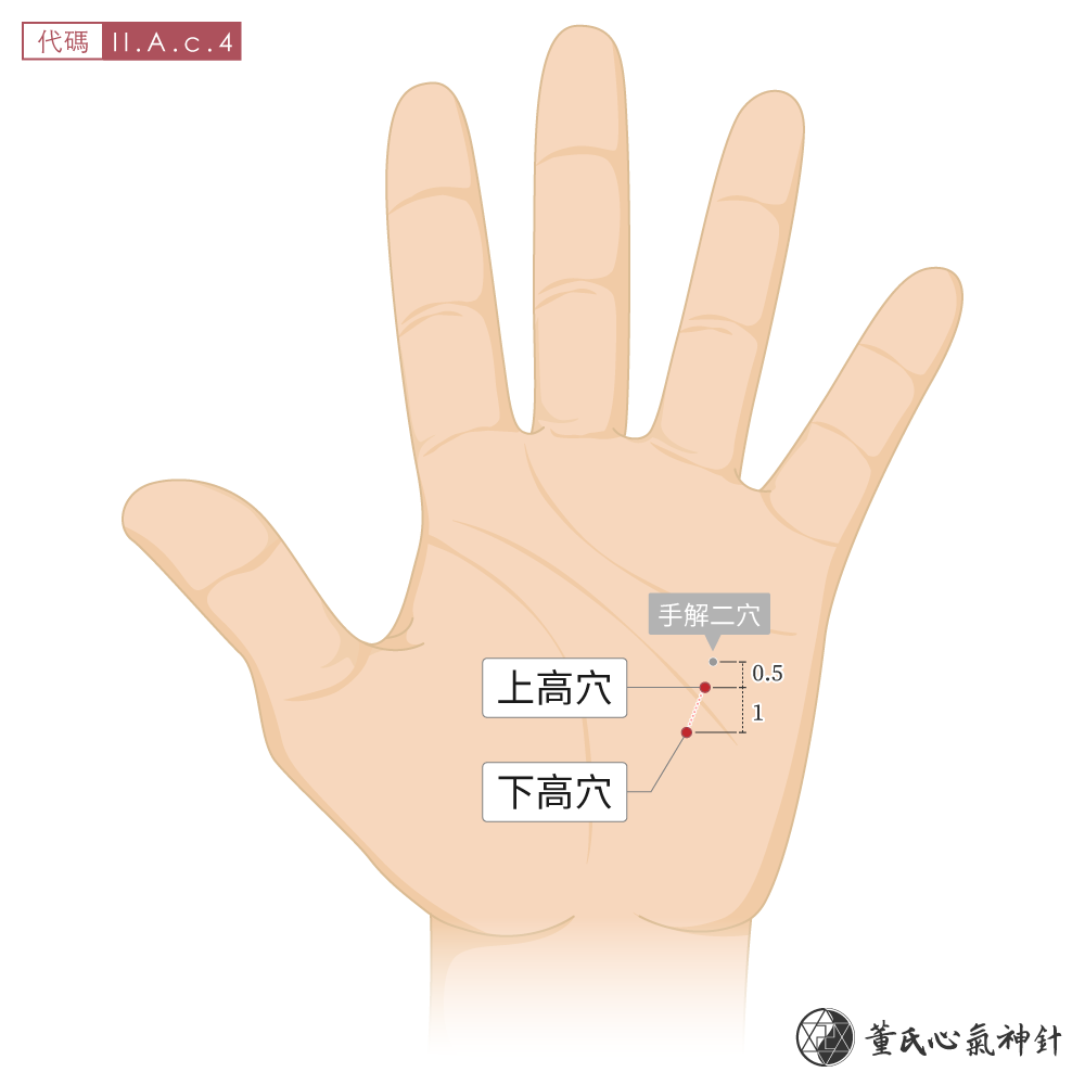 上高穴、下高穴位於四掌骨掌面高區左手示意圖