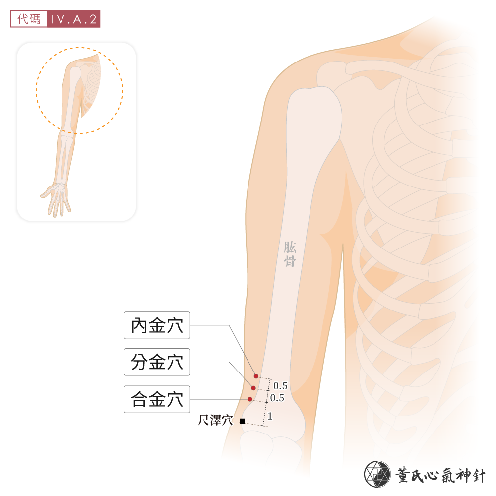 分金穴、合金穴、內金穴位於上臂前側手金區示意圖