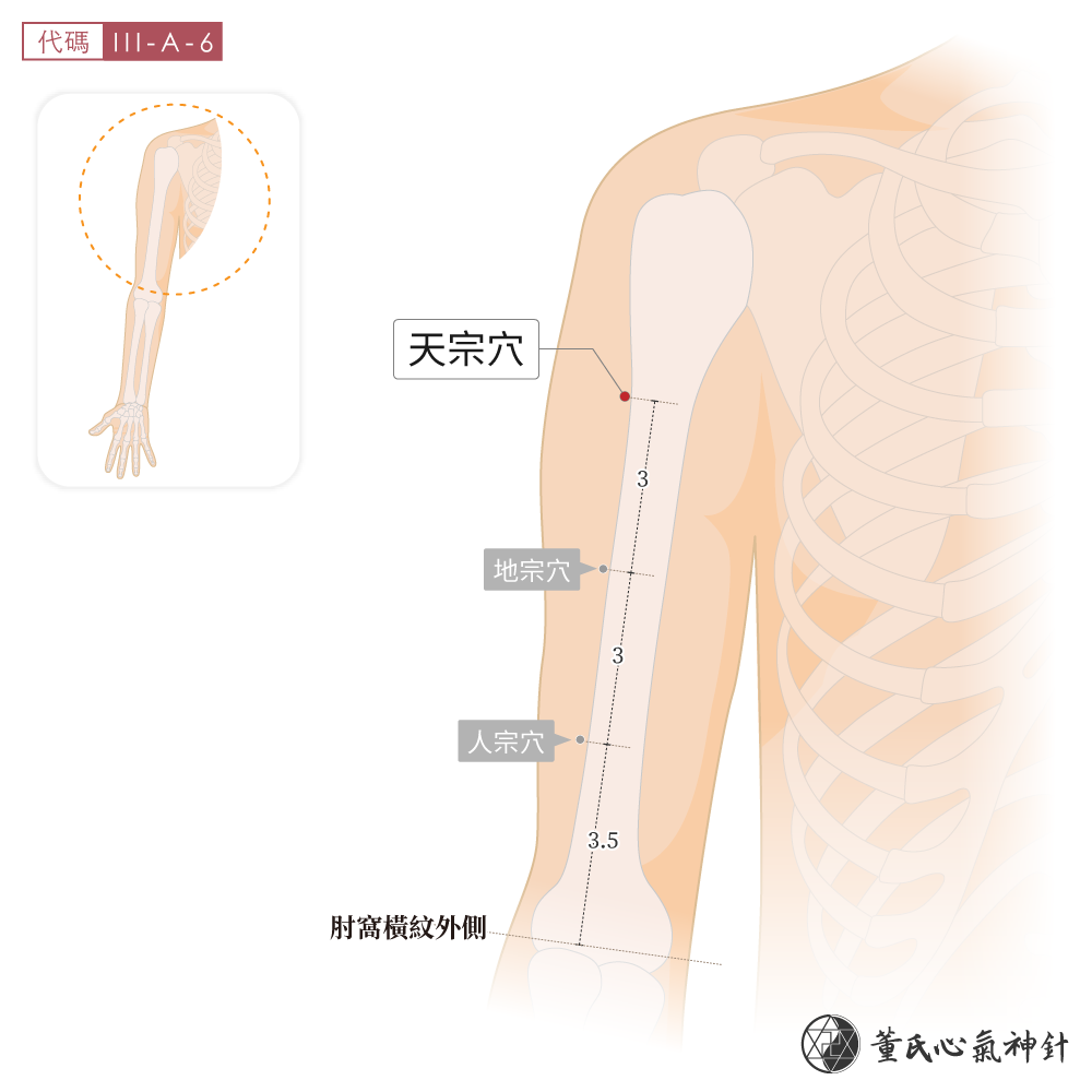 天宗穴位於上臂前側宗區示意圖