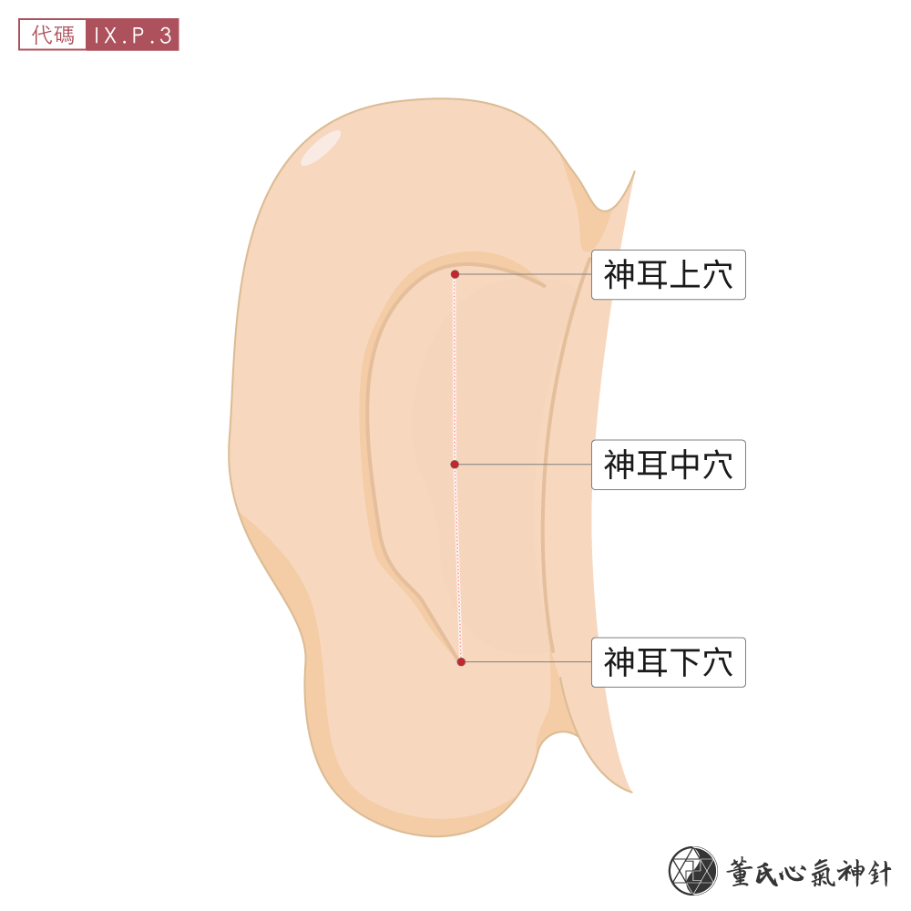 神耳穴位於耳朵後側神耳區。耳廓背面共計三穴示意圖
