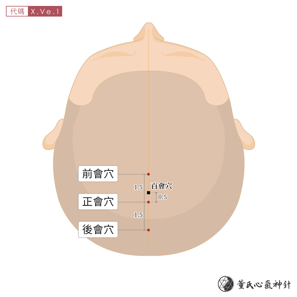 正會穴、前會穴、後會穴位於頭頂部位頭會區示意圖